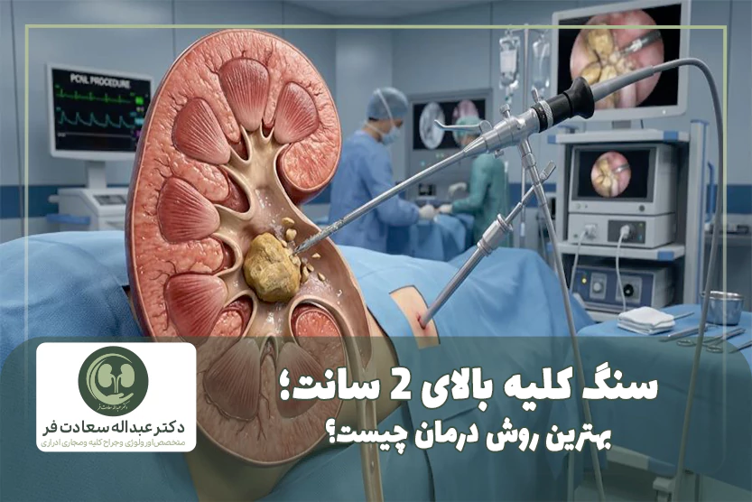 سنگ کلیه بالای 2 سانت؛ چه زمانی PCNL بهترین روش درمان است؟