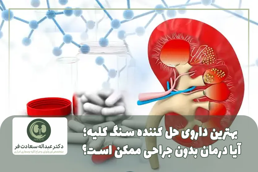 بهترین داروی حل کننده سنگ کلیه؛ آیا درمان بدون جراحی ممکن است؟
