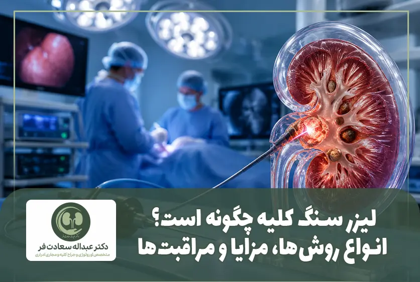 لیزر سنگ کلیه چگونه است؟ انواع روش_ها، مزایا و مراقبت_ها