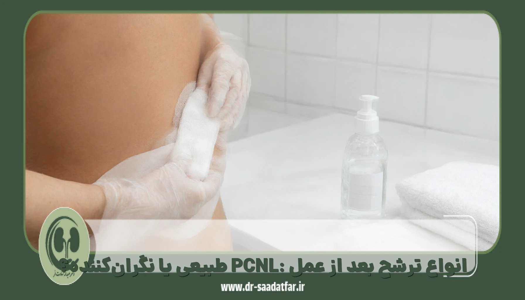 انواع ترشح بعد از عمل PCNL: طبیعی یا نگرانکننده؟