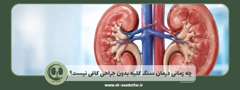 چه زمانی درمان سنگ کلیه بدون جراحی کافی نیست؟